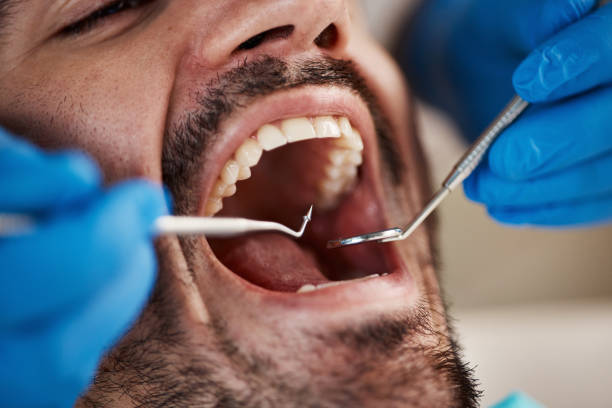 Best Urgent Tooth Repair  in Mars, PA